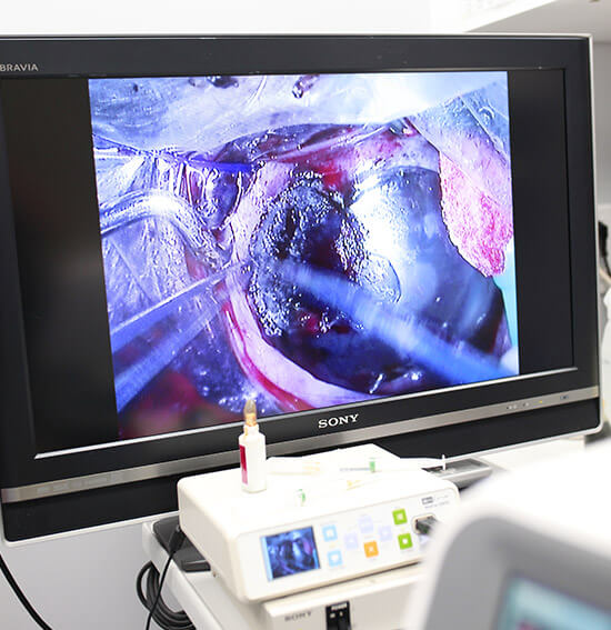 Vétérinaire suivant une opération de chirurgie laser avec double écran de contrôle