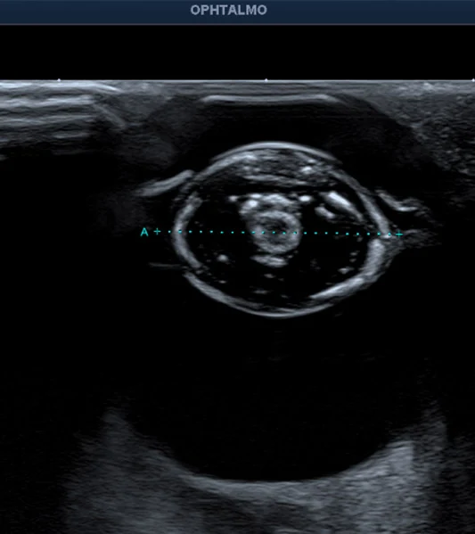 Echographique oculaire : oeil d'un chien