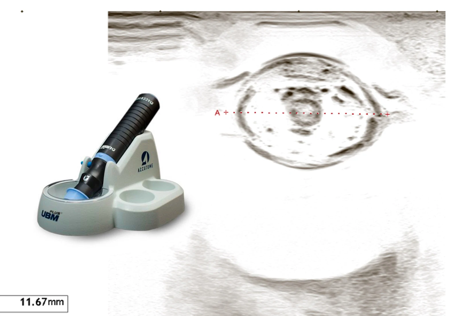 Echographie de l'oeil d'un chien, avec un UBM