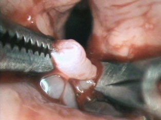 Endoscopie chien