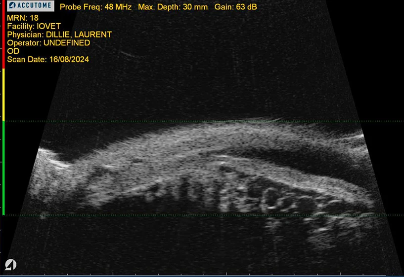 Echographie d'un kyste sur l'oeil d'un chien, au sein des procès ciliaires