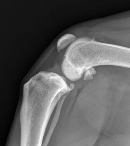Radiographie du ligament croisé déchiré d'un chien